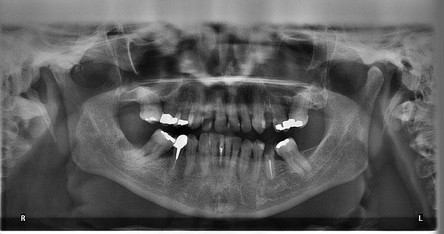 dental x ray