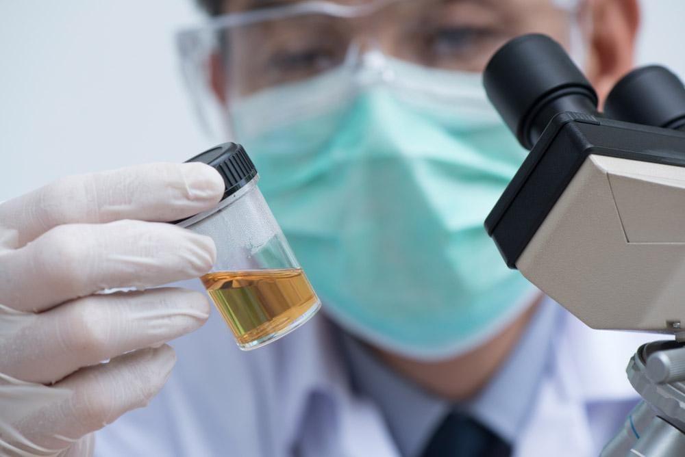 Synthetic Urine Synthetic Urine