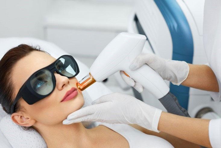 Laser-hair-Removal