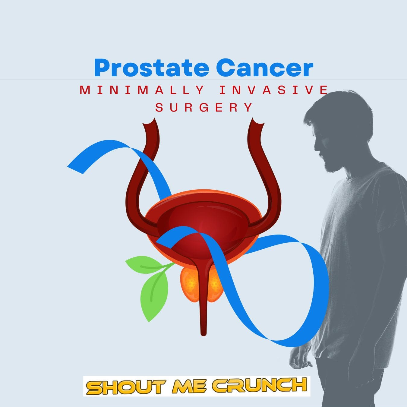 Prostate Cancer Prostate Cancer